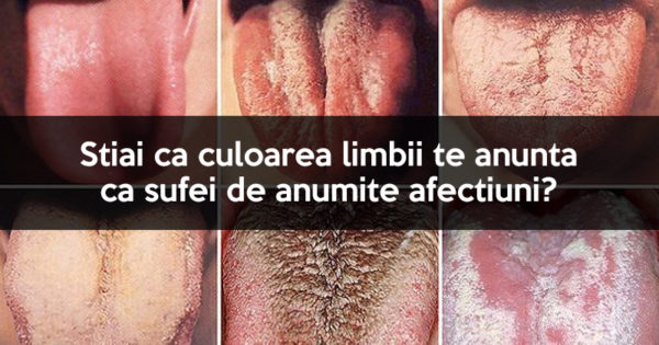 Stiai ca culoarea limbii tale te poate avertiza de o boala cu care confrunta corpul tau?