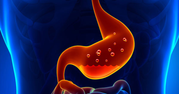 Arsurile la stomac sunt cele mai raspandite probleme de sanatate – afla cum poti scapa de aceste efecte ale acidului gastric