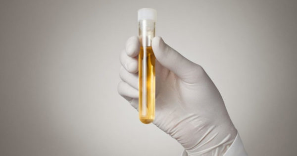 Rubrica de sănătate: Diabetul și alte motive pentru care urina are o culoare și un miros diferit