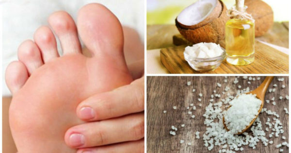 8 remedii casnice pentru a rezolva problema mâinilor și picioarelor umflate