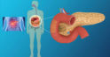 8 semne ale bolii pancreasului – Pancreatita