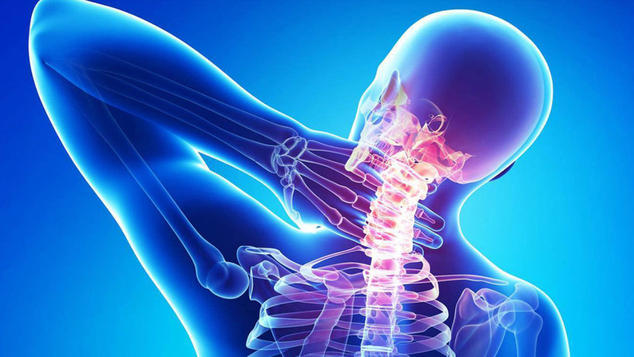 cum să eliminați osteocondroza cervicală cel mai bun remediu pentru durerile de spate