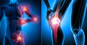 6 simptome care anunță un început de artrită pe care nu trebuie să le ignorați
