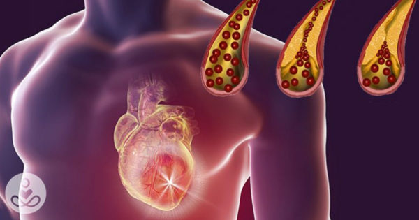 11 produse pentru vasele de sânge și inimă: vor îmbunătăți activitatea sistemului cardiovascular și vor ajuta la evitarea infarctului