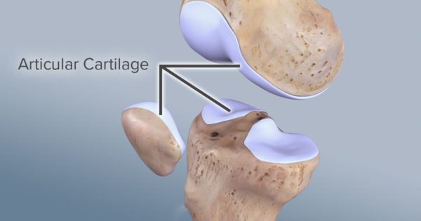alimente pentru refacerea cartilajelor dureros pe îndoirea genunchiului