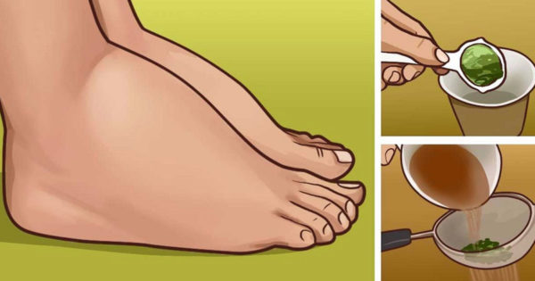„Piciorul diabetic“: senzaţia de picioare reci nu dispare prin încălzirea lor cu sticle!