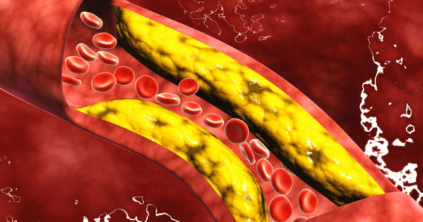 Lucruri importante despre colesterol despre care puțini oameni le cunosc