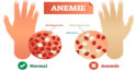 Ce remedii naturale să folosiți în cazul anemiei: 5 dintre cele mai bune băuturi pentru a completa carența de fier din organism
