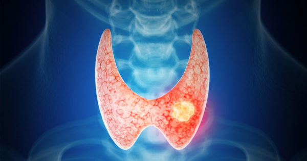 Rolul glandei tiroide în organism. De ce este foarte important să avem grijă de glanda tiroidă