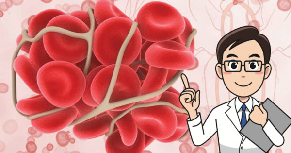Remedii naturale care subțiază sângele și previn formarea cheagurilor de sânge