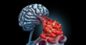 Îmbunătățirea circulației sângelui în creier: un set de trei exerciții