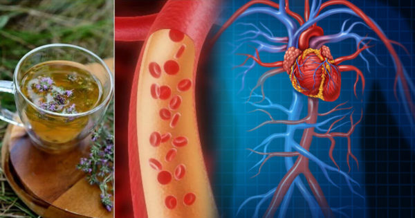 Colesterol ridicat: 6 remedii pe bază de plante