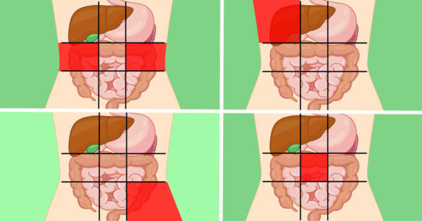 Medicii au creat o hartă a abdomenului, care arată ce poate provoca dureri abdominale