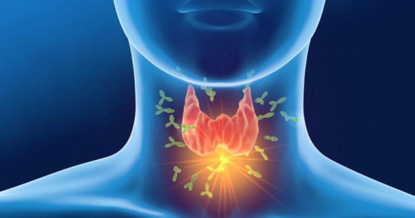 Sănătatea tiroidei: 8 reguli de aur