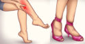 6 simptome neevidente ale varicelor picioarelor și cum se previn