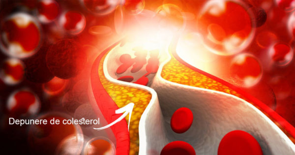 Cinci produse care curăță vasele de sânge de colesterol!