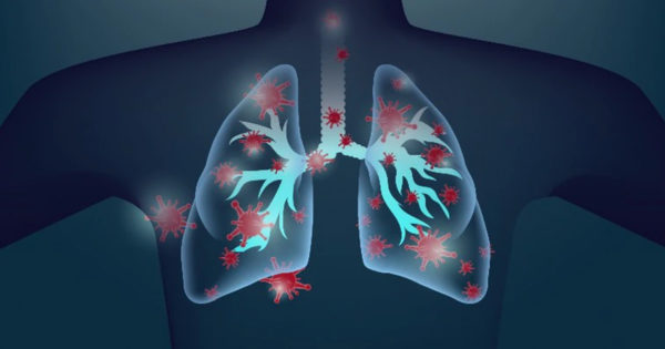 Cum să distingi pneumonia de o răceală sau gripă. Simptome la care trebuie să acorzi atenție