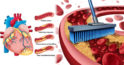4 remedii naturale pentru curățarea și deblocarea arterelor
