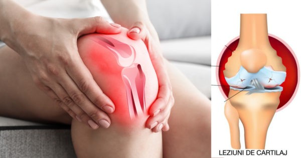 Durerea de genunchi – remedii naturale care vă pun pe picioare