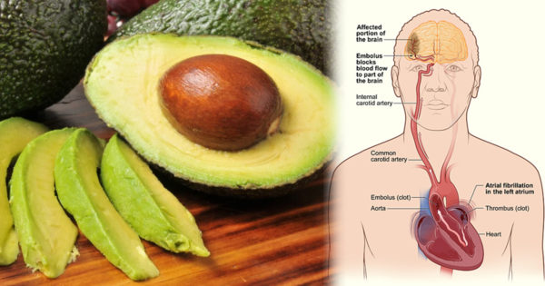 Beneficiile consumului de avocado – normalizează ritmul cardiac și îmbunătățește funcția creierului