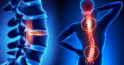 Osteocondroza, tipuri și cauze ale durerilor de spate