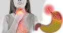 Patru moduri de a scăpa de refluxul gastric