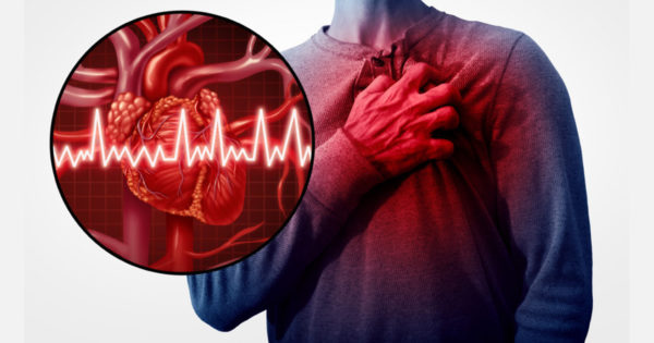 Infarctul miocardic: a fost stabilită vârsta la care sunteți cel mai expus riscului de infarct