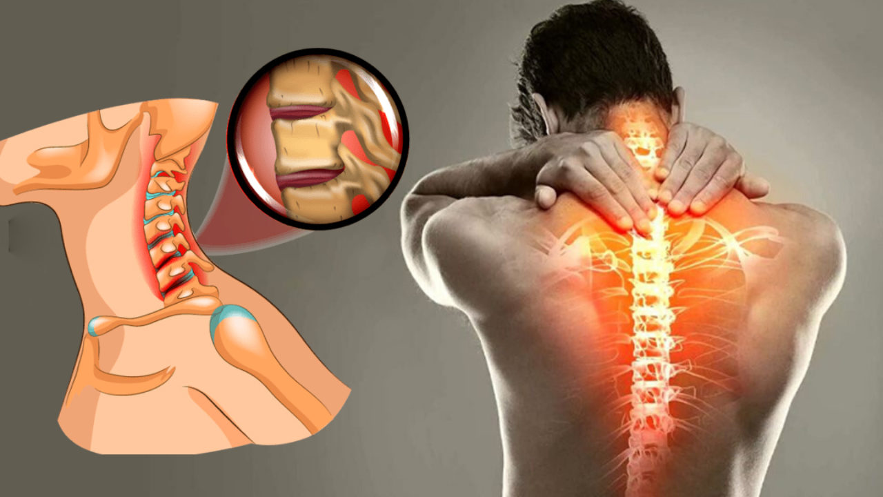 eliminarea durerilor articulare tratament medicamentos al coloanei vertebrale