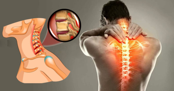 Durerea lombara – prevenire, cauze, simptome, tratament, Medicamente pentru durerile lombare
