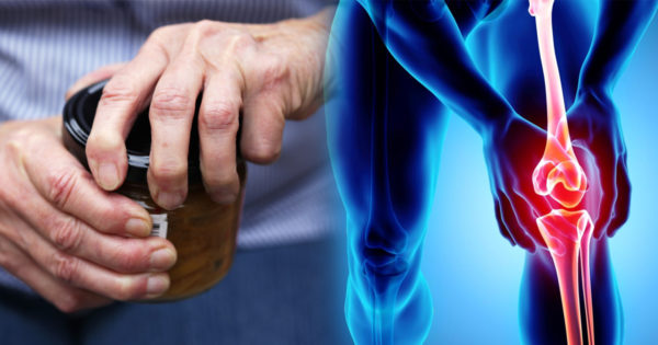 7 remedii pentru calmarea simptomelor artritei