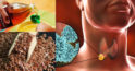 5 remedii naturale pentru problemele glandei tiroide