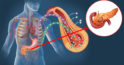 Pancreasul este cel mai misterios organ. Rolul acestuia în organism și cum să ne dăm seama când suferă