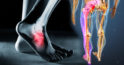 Picioare umflate: 9 cauze și ce trebuie să faceți pentru a le trata