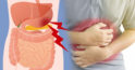 Durerile de stomac: 6 cauze principale și cum le putem combate