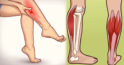 Crampele la picioare: cauze și mod de evitare