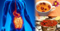 Agravarea pancreatitei și a altor boli ale tractului gastrointestinal în perioada sezonului rece: ce trebuie să știți și cum să preveniți