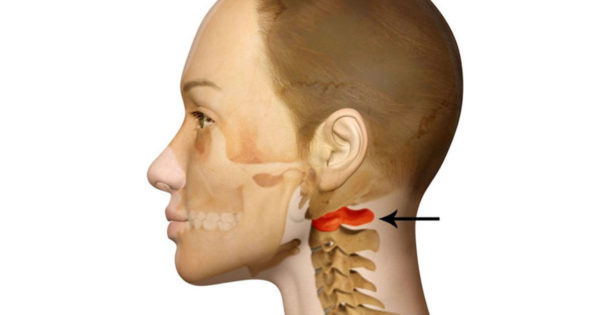 Motivul ascuns al durerii de cap – deplasarea atlasului: Cum să vă dați seama dacă prima vertebră cervicală nu este la locul său