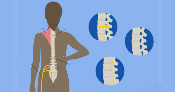 Sfatul unui neurochirurg: 7 exerciții care vor ajuta la ameliorarea durerilor de spate