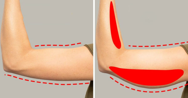 Un medic cu experiență: „Două exerciții simple pentru ca pielea de pe brațe și picioare să nu se lase”