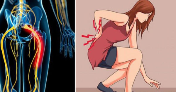 Durerea de spate iradiază către picior: cauze și cum să le tratăm