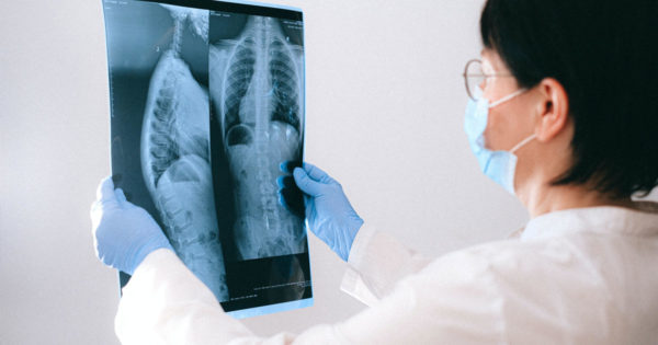 Este periculos să faci o radiografie? Câte radiografii poți face anual?