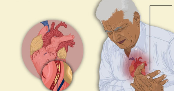 Prin ce semnale ne avertizează inima cu privire la amenințarea de infarct?